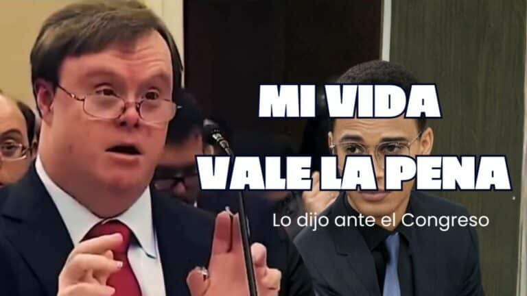 Joven con Síndrome de Down